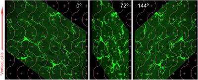 Multiple Morphometric Assessment of Microglial Cells in Deafferented Spinal Trigeminal Nucleus